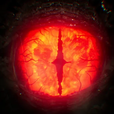 Eye